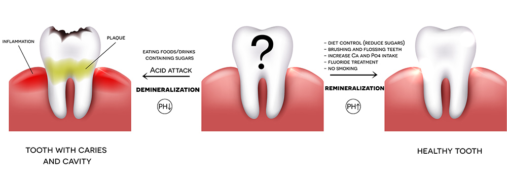 Dental Health Care Illustration - Dr. Reza Khazaie, DDS