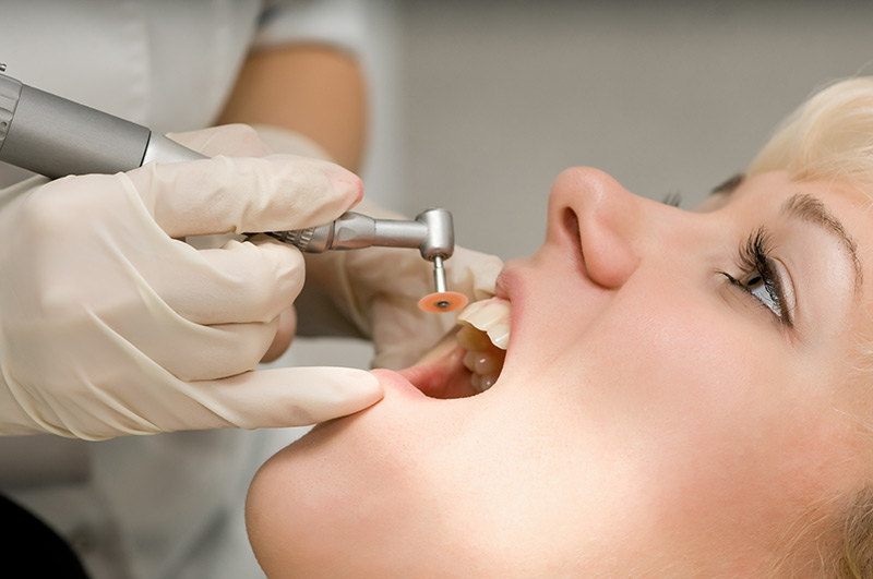 Step 3 of Dental Sealant procedure