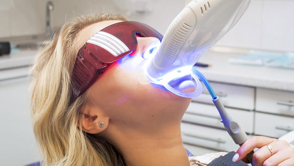 Dental Whitening Treatment