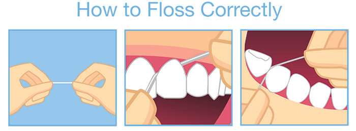 How To Floss - Willow Pass Dental Care - The Leading Dentist in Walnut Creek, CA.