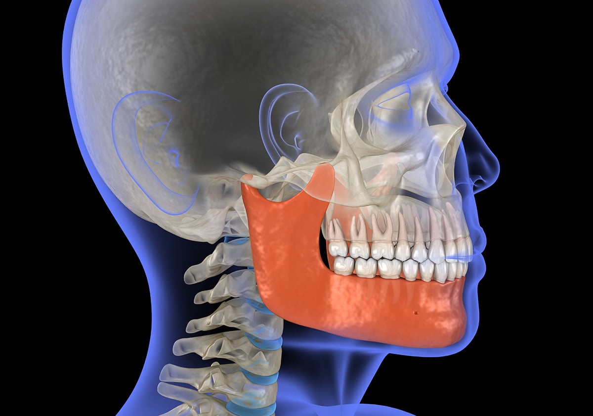 corrective jaw surgery - dentist in Concord, CA