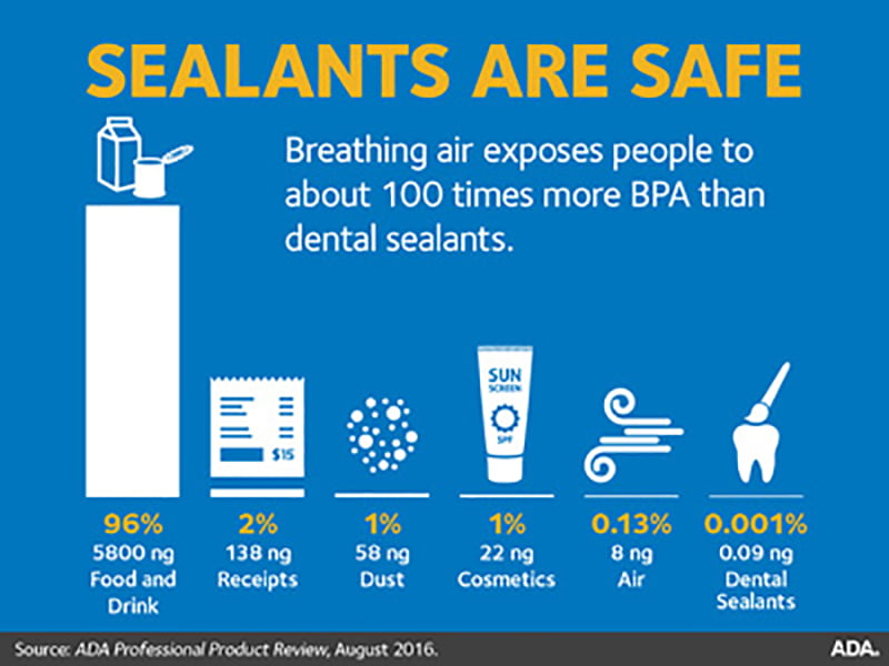 Teeth Sealants Are Safe - ADA