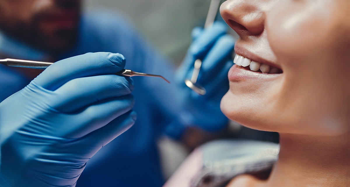 How Does A Cavity Filling Work? - Concord Dentist CA