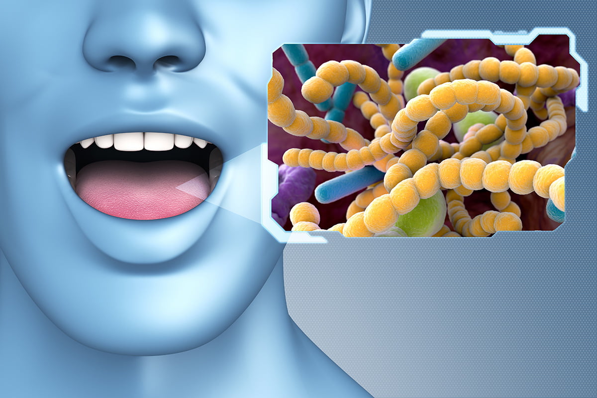 Bad Breath - Microbes bacteria - Concord Dentist