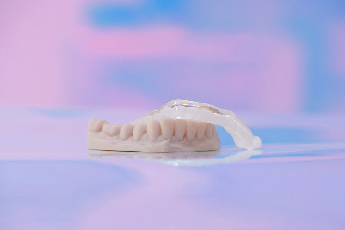 Bruxism Definition - Willow Pass Dental Care - Concord, CA