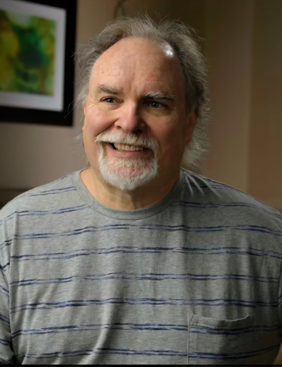 Bob Busser, patient of Dr.Reza Khazaie, Prosthodontist at Willow Pass Dental Care, Concord, CA
