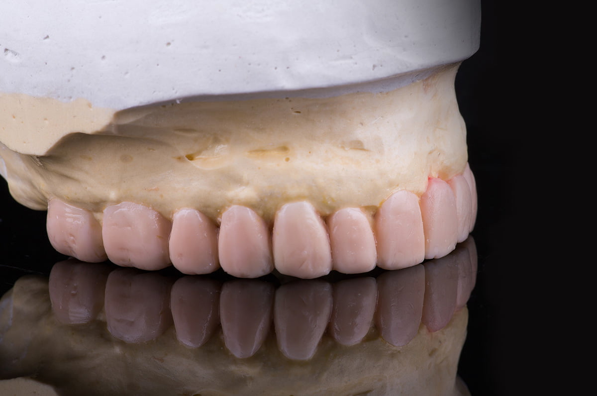 Concord dentures